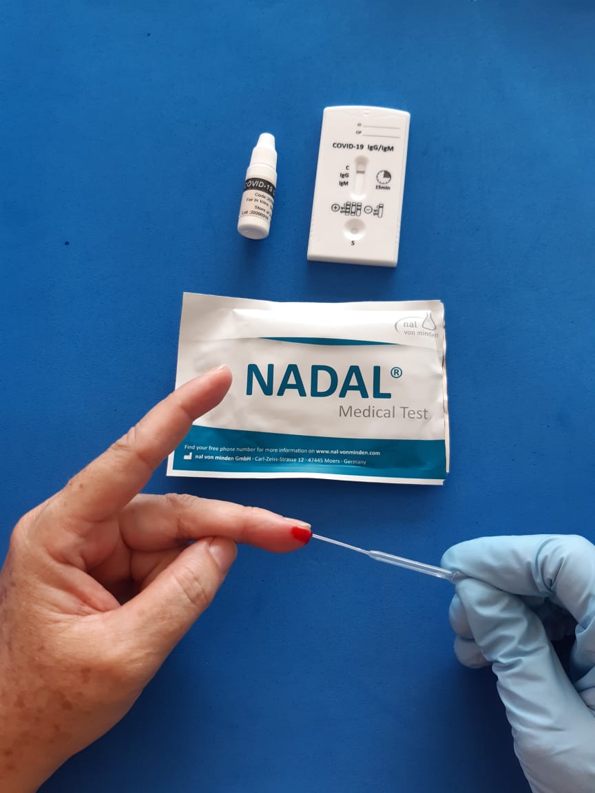 pruebas rapidas para covid19 coronavirus